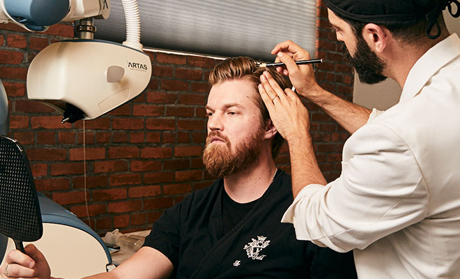 ARTAS For Patients In Their 20s & 30s