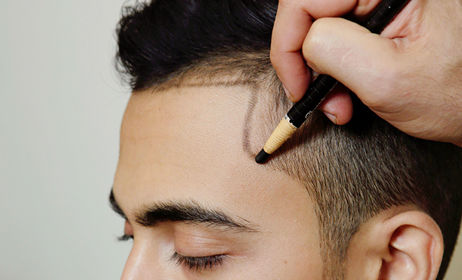 ARTAS For Asian & Indian Hair